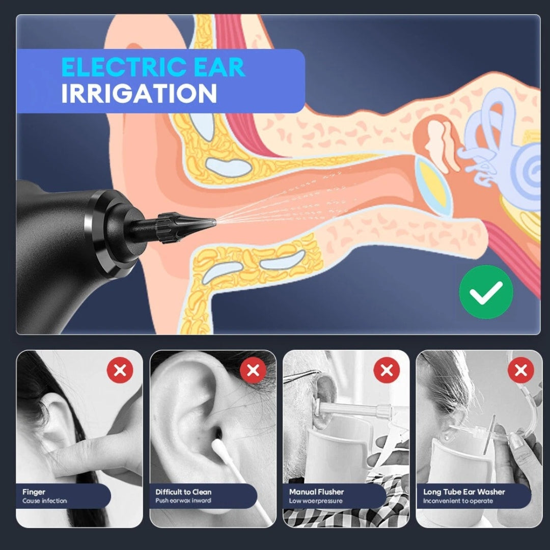 ZenRinse™ - Ear Wax Remover