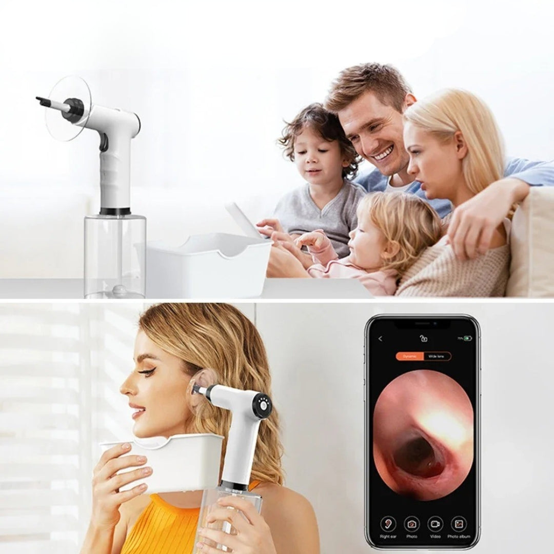 VelvaSpray™ - Ear Wax Remover