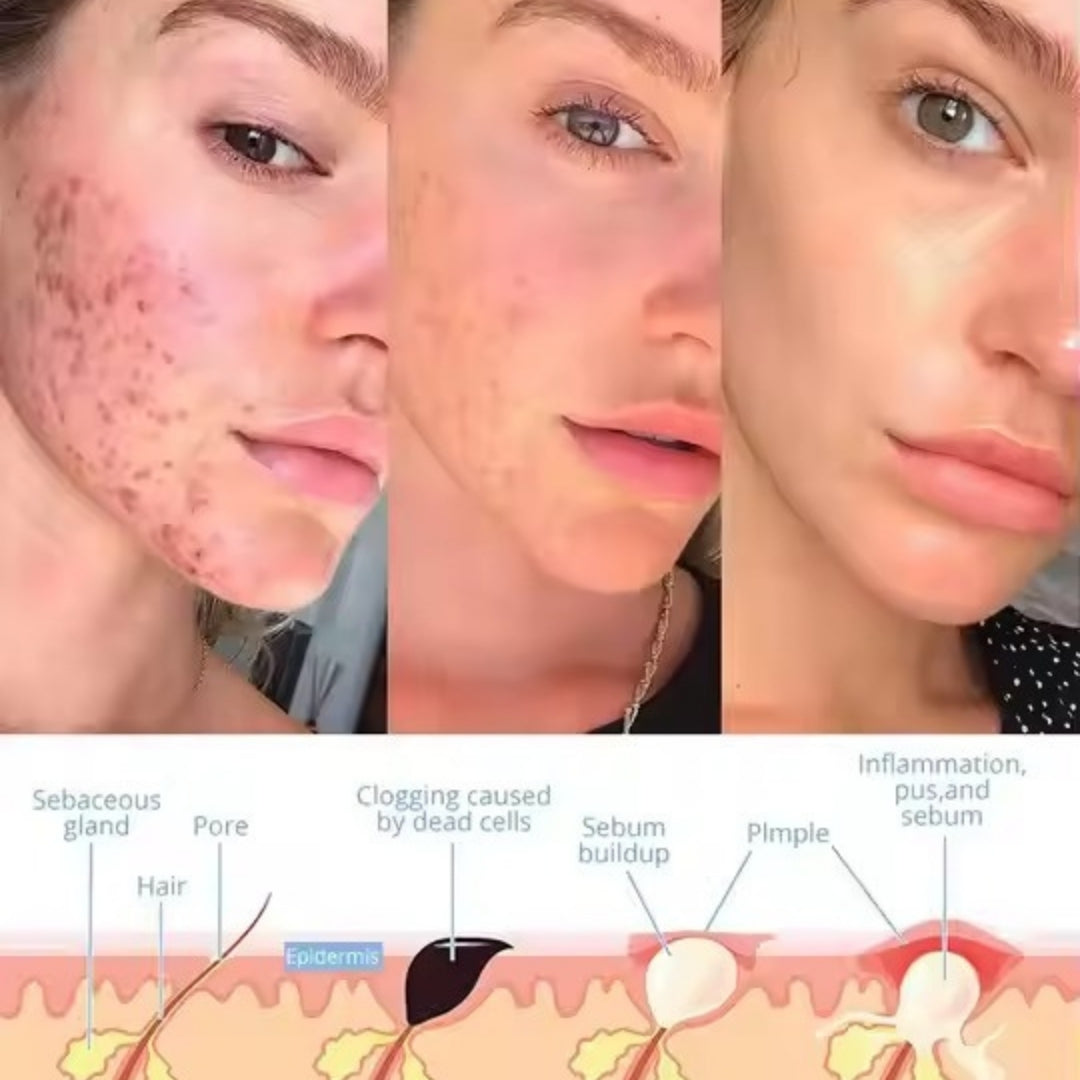LustraSkin™ - Facial Wand