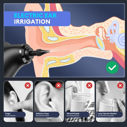 ZenRinse™ - Ear Wax Remover