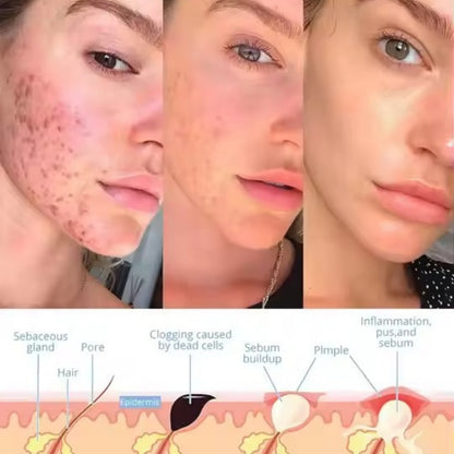 LustraSkin™ - Facial Wand
