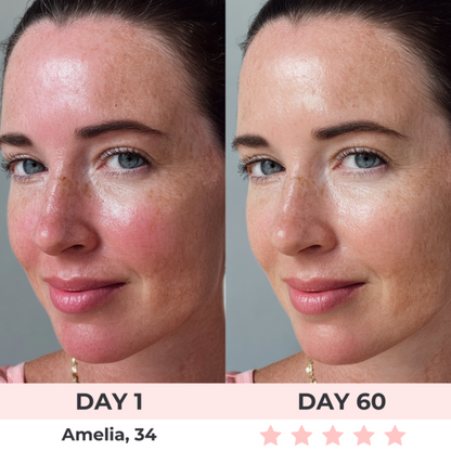 LumiMask™ - LED Face Mask