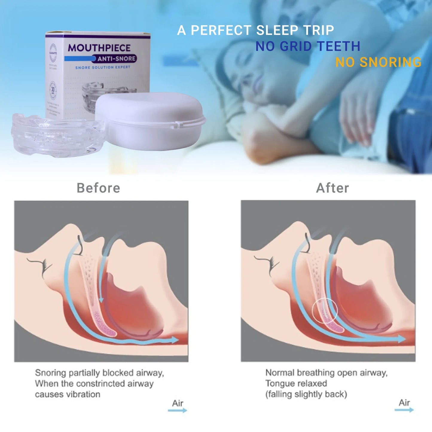 DreamGuard Snore Solution