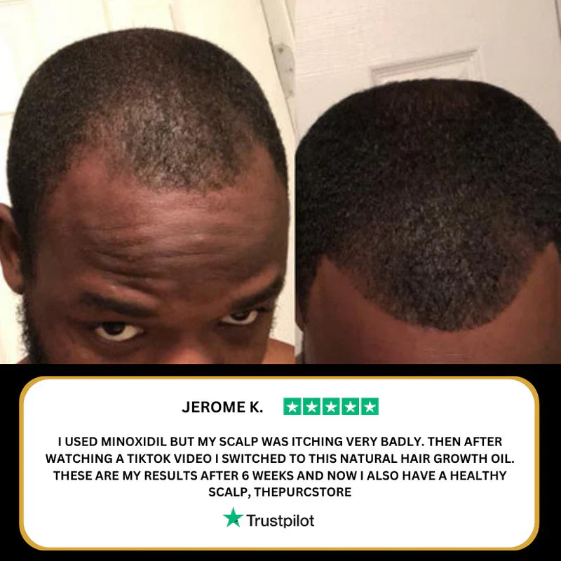 RootRevive™ Hair Repair & Growth Oil